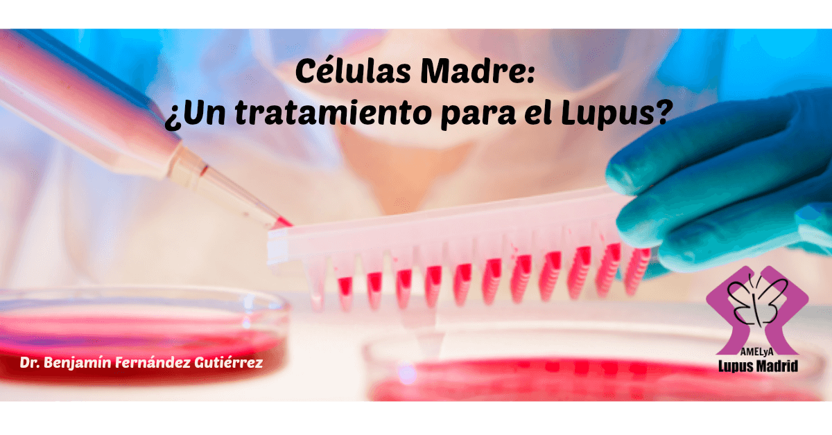 Células madre: ¿Un tratamiento para el lupus?
